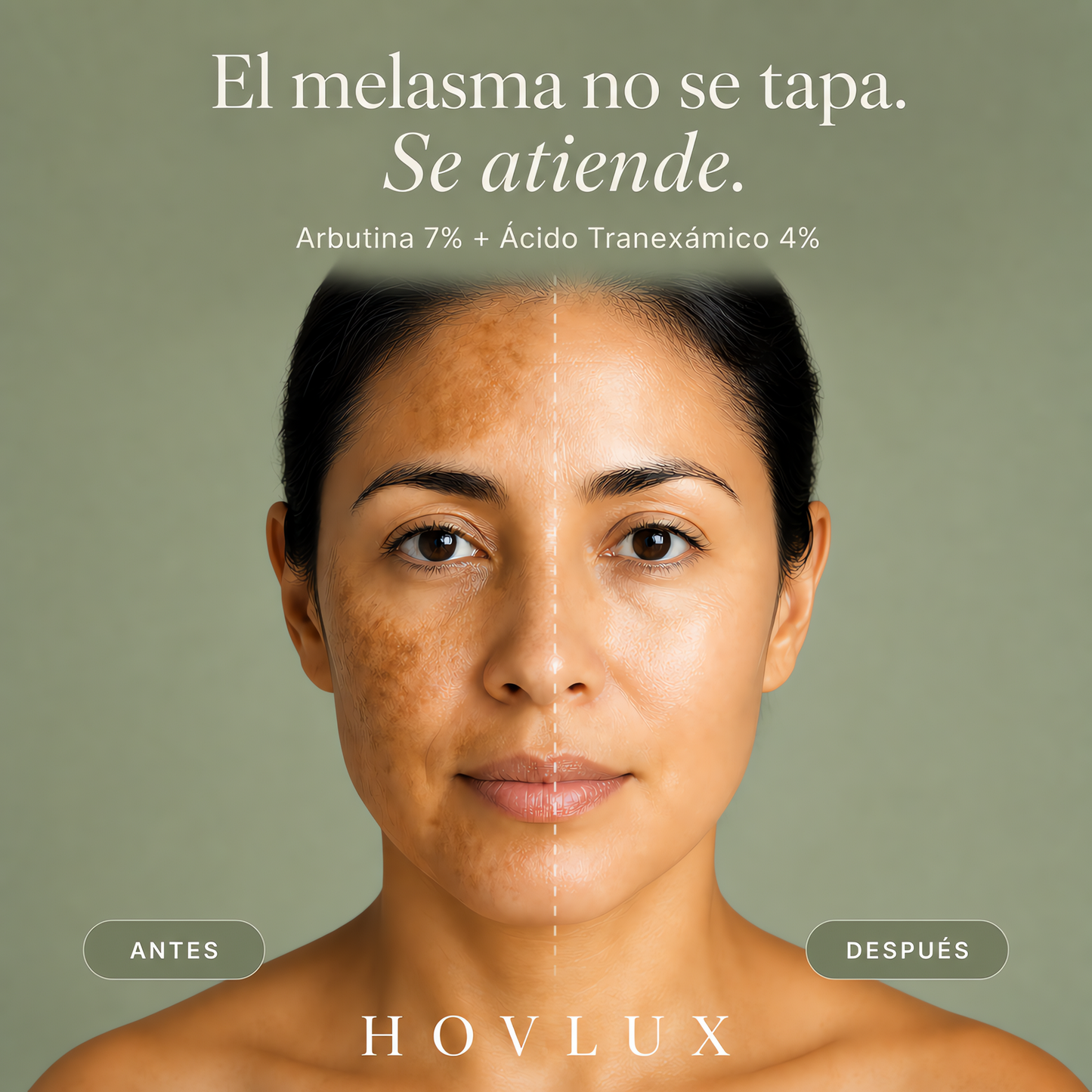 Crema Despigmentante - Sistema Doble Bloqueo